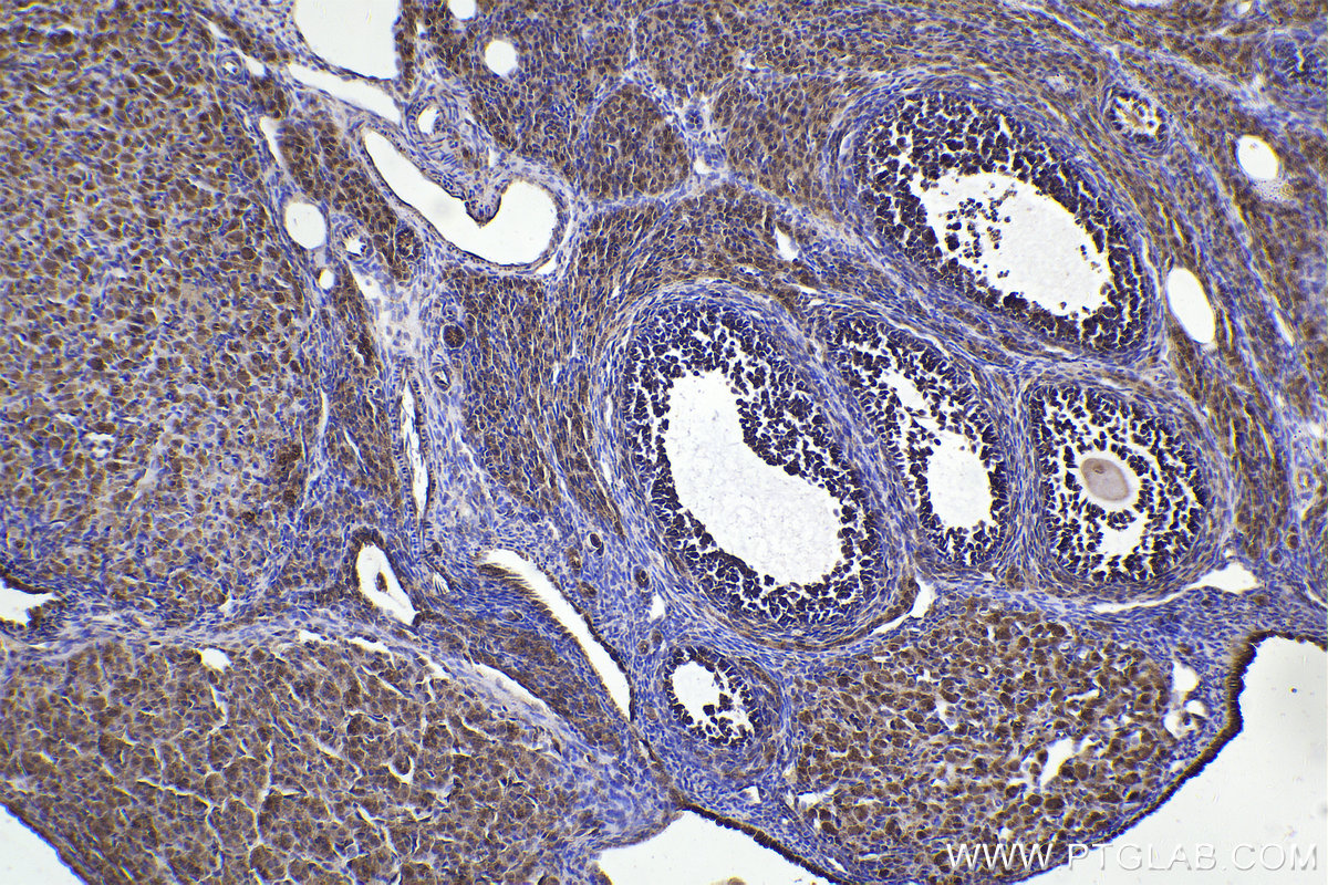 Immunohistochemical analysis of paraffin-embedded rat ovary tissue slide using KHC2252 (CHRNA7 IHC Kit).