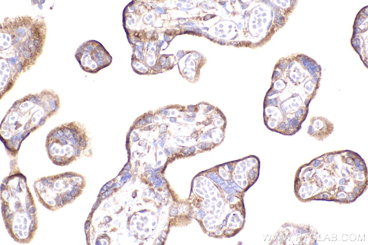 Immunohistochemical analysis of paraffin-embedded human placenta tissue slide using KHC2444 (CKAP5/Ch-TOG IHC Kit).