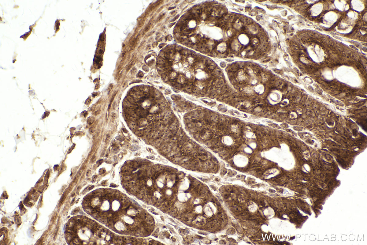 Immunohistochemical analysis of paraffin-embedded rat colon tissue slide using KHC2463 (CLINT1 IHC Kit).