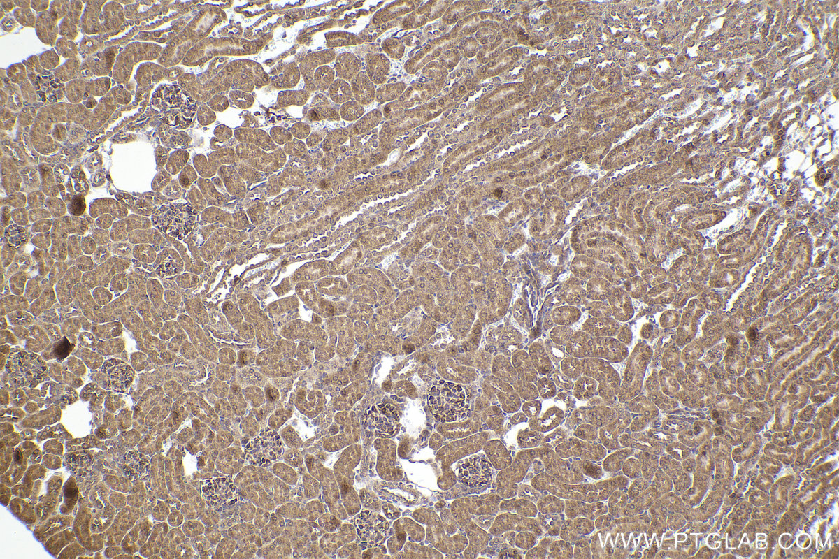 Immunohistochemical analysis of paraffin-embedded mouse kidney tissue slide using KHC2230 (CLIP1 IHC Kit).