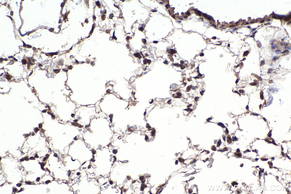 Immunohistochemical analysis of paraffin-embedded mouse lung tissue slide using KHC2323 (CLNS1A IHC Kit).