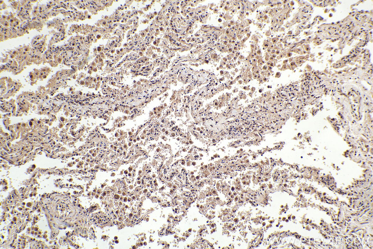 Immunohistochemical analysis of paraffin-embedded human lung tissue slide using KHC2323 (CLNS1A IHC Kit).