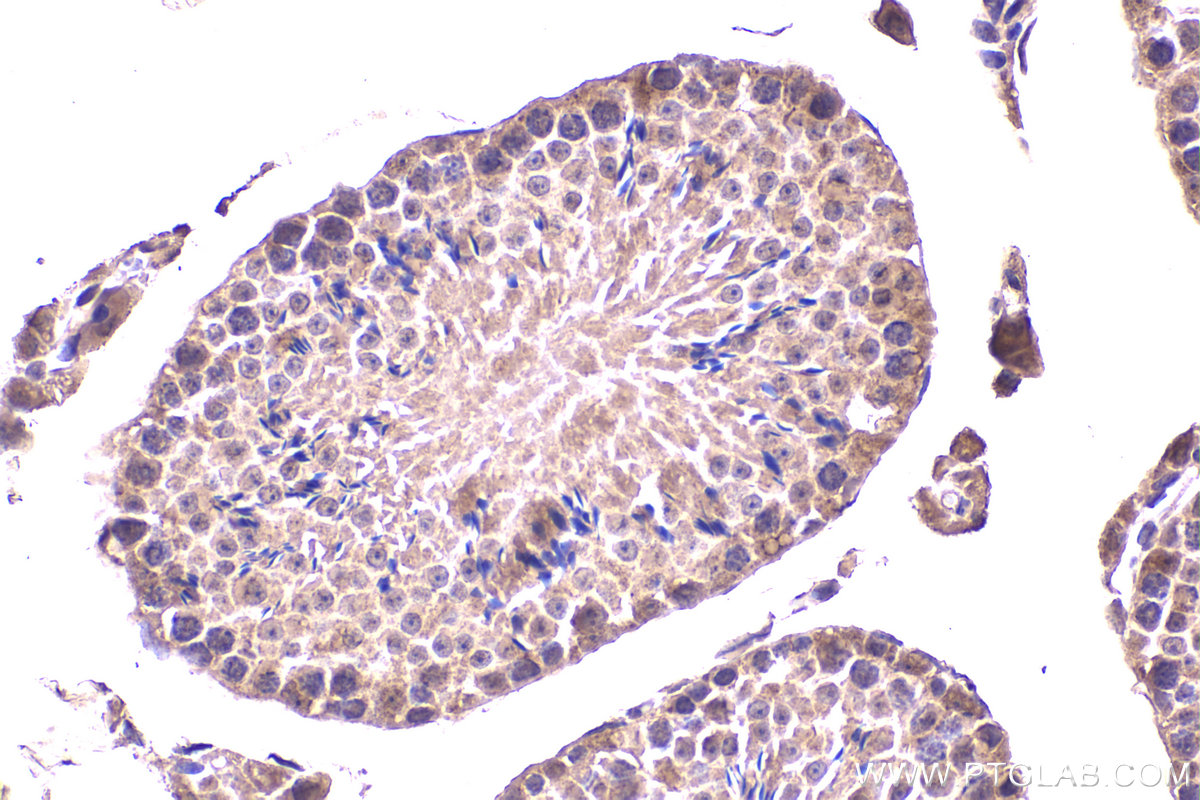 Immunohistochemical analysis of paraffin-embedded mouse testis tissue slide using KHC2319 (CLTCL1 IHC Kit).