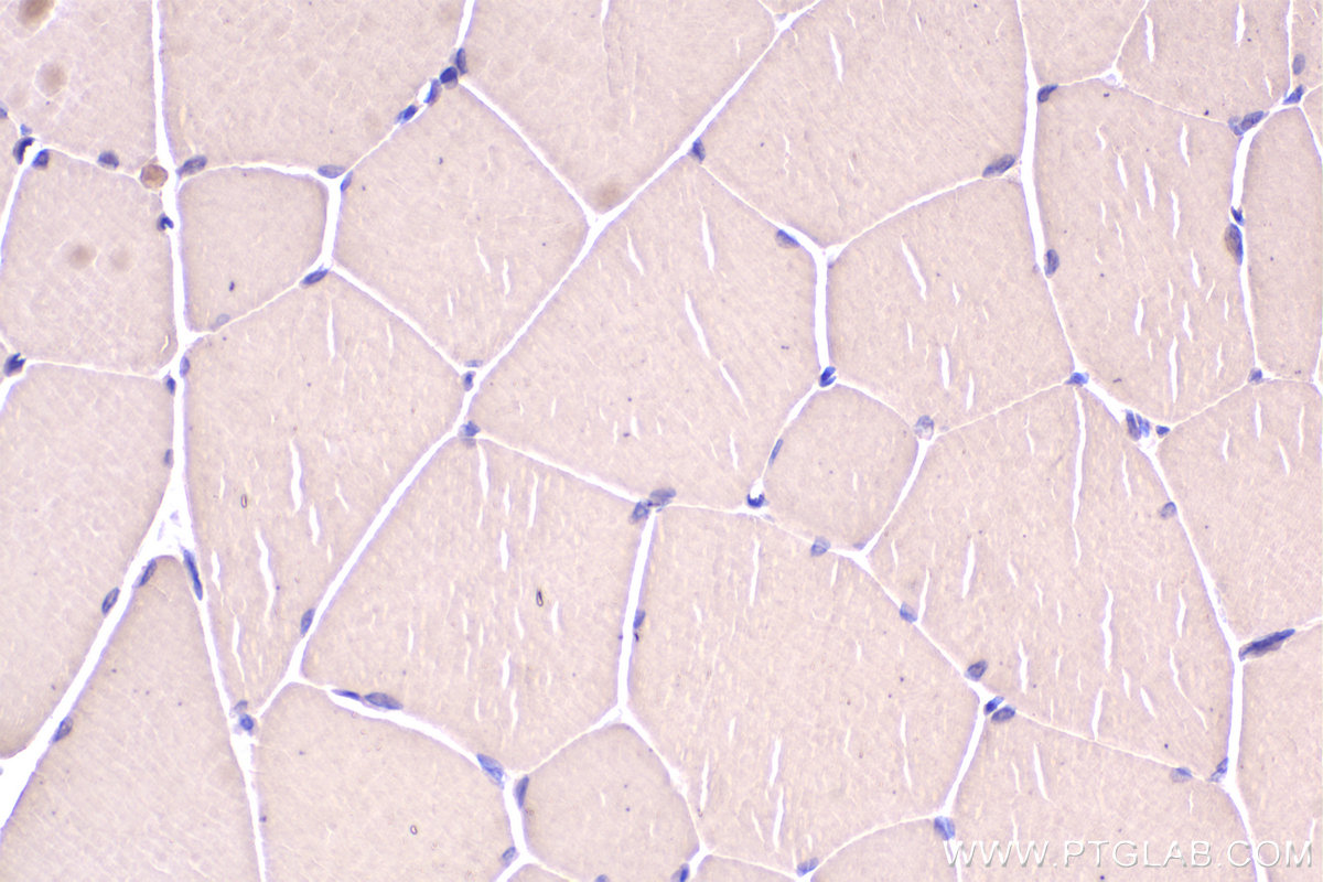 Immunohistochemical analysis of paraffin-embedded rat skeletal muscle tissue slide using KHC2319 (CLTCL1 IHC Kit).