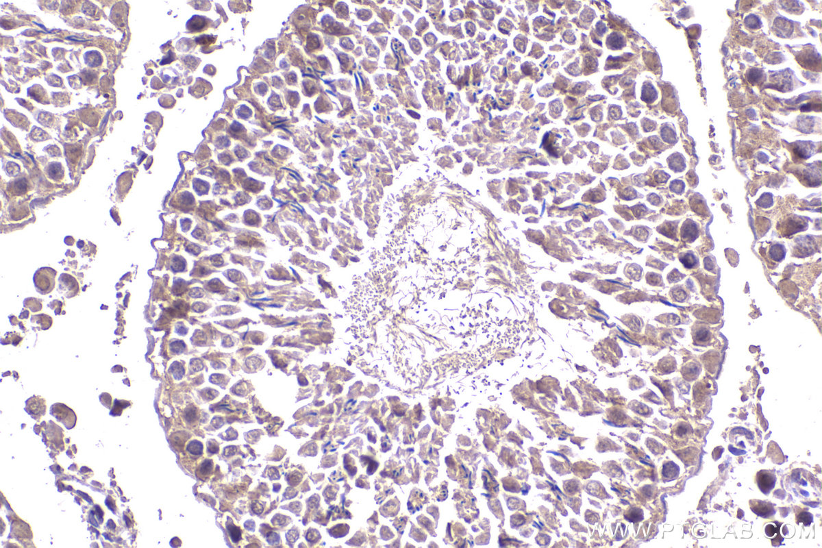 Immunohistochemical analysis of paraffin-embedded rat testis tissue slide using KHC2319 (CLTCL1 IHC Kit).