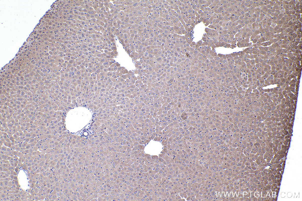 Immunohistochemical analysis of paraffin-embedded mouse liver tissue slide using KHC2371 (COG7 IHC Kit).