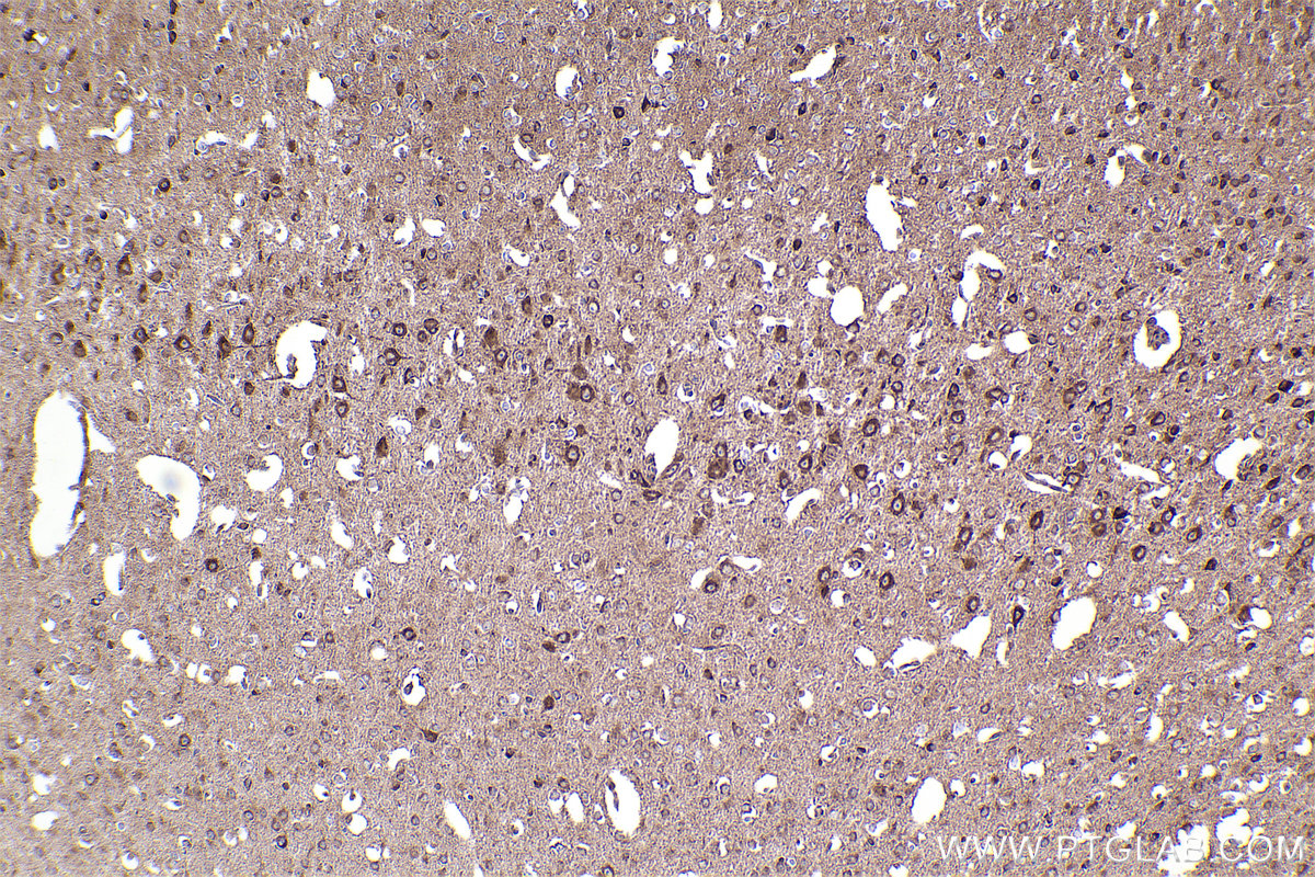 Immunohistochemical analysis of paraffin-embedded mouse brain tissue slide using KHC2371 (COG7 IHC Kit).