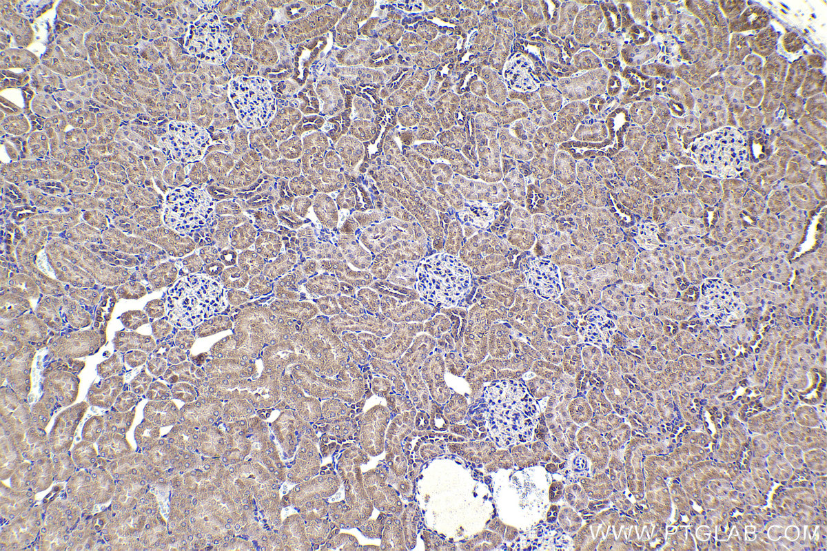 Immunohistochemical analysis of paraffin-embedded rat kidney tissue slide using KHC2315 (COPB1 IHC Kit).