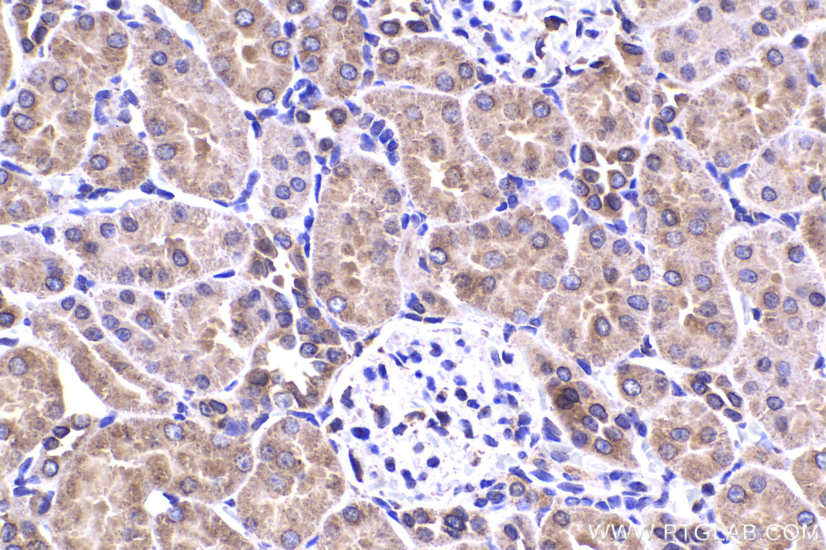 Immunohistochemical analysis of paraffin-embedded rat kidney tissue slide using KHC2247 (COPB2 IHC Kit).