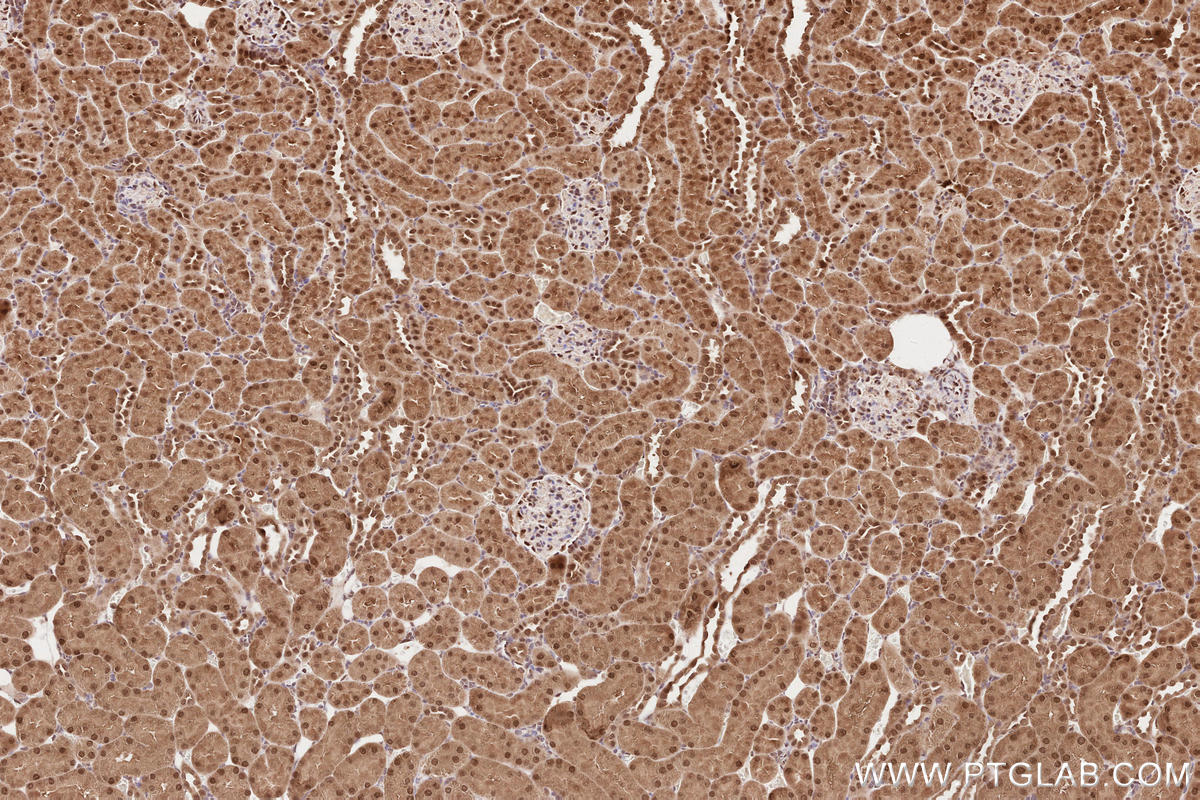 Immunohistochemical analysis of paraffin-embedded rat kidney tissue slide using KHC2614 (COPS6 IHC Kit).