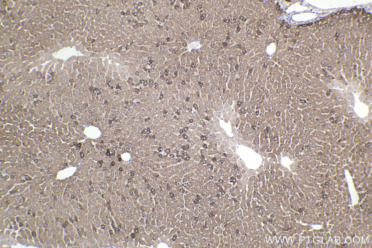 Immunohistochemical analysis of paraffin-embedded mouse liver tissue slide using KHC2268 (CPS1 IHC Kit).