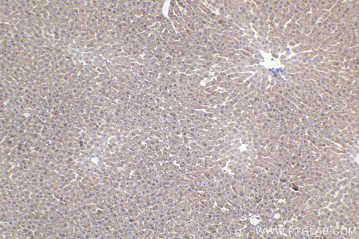 Immunohistochemical analysis of paraffin-embedded rat liver tissue slide using KHC2268 (CPS1 IHC Kit).