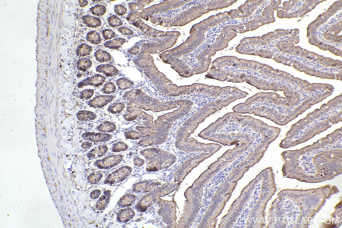 Immunohistochemical analysis of paraffin-embedded rat small intestine tissue slide using KHC2268 (CPS1 IHC Kit).