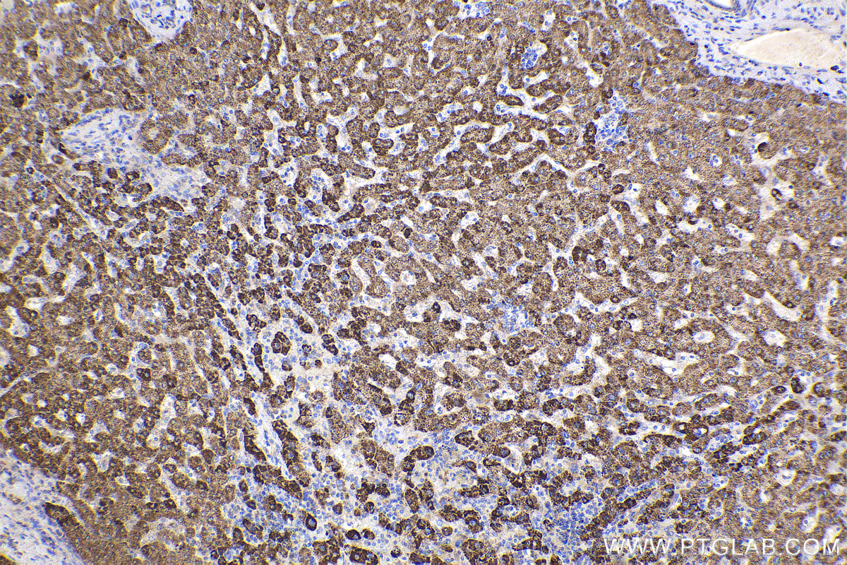 Immunohistochemical analysis of paraffin-embedded human liver tissue slide using KHC2268 (CPS1 IHC Kit).