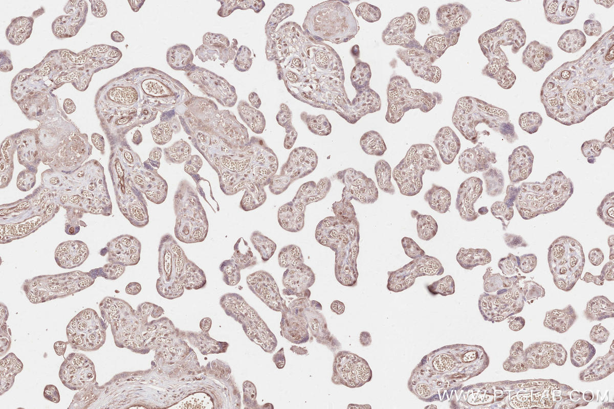 Immunohistochemical analysis of paraffin-embedded human placenta tissue slide using KHC2530 (CRY2 IHC Kit).