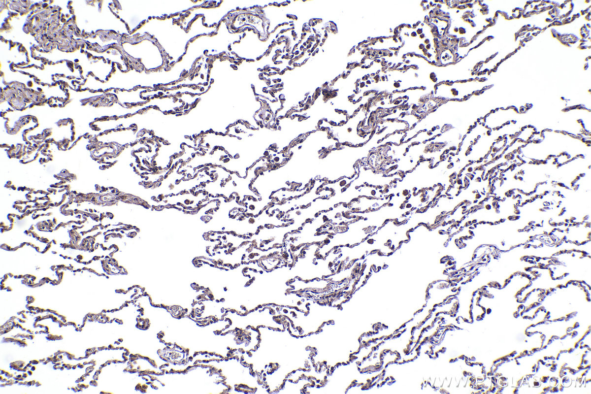 Immunohistochemical analysis of paraffin-embedded human lung tissue slide using KHC2259 (CSK IHC Kit).