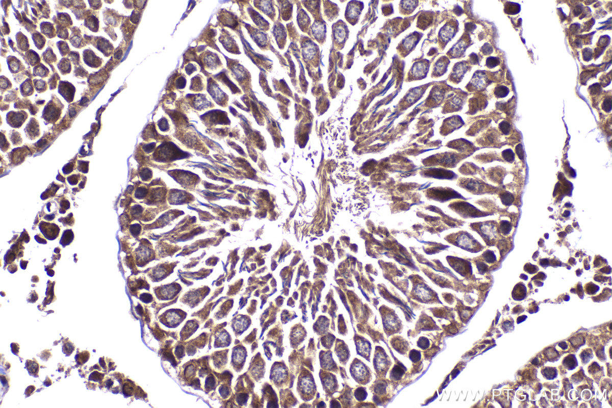 Immunohistochemical analysis of paraffin-embedded rat testis tissue slide using KHC2259 (CSK IHC Kit).