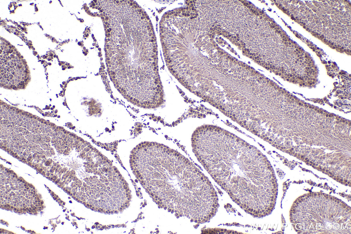 Immunohistochemical analysis of paraffin-embedded rat testis tissue slide using KHC2346 (CSNK1A1 IHC Kit).