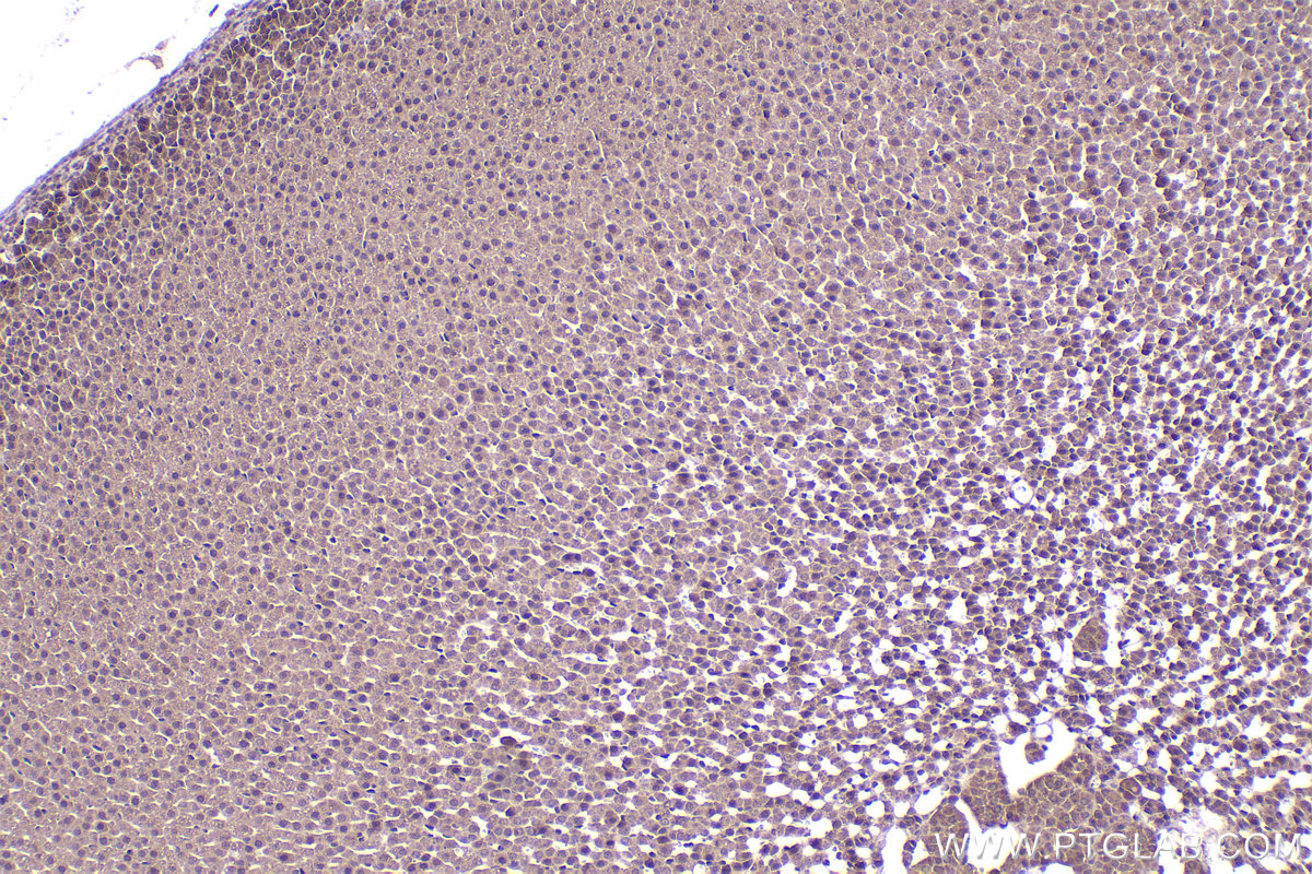 Immunohistochemical analysis of paraffin-embedded rat adrenal gland tissue slide using KHC2346 (CSNK1A1 IHC Kit).