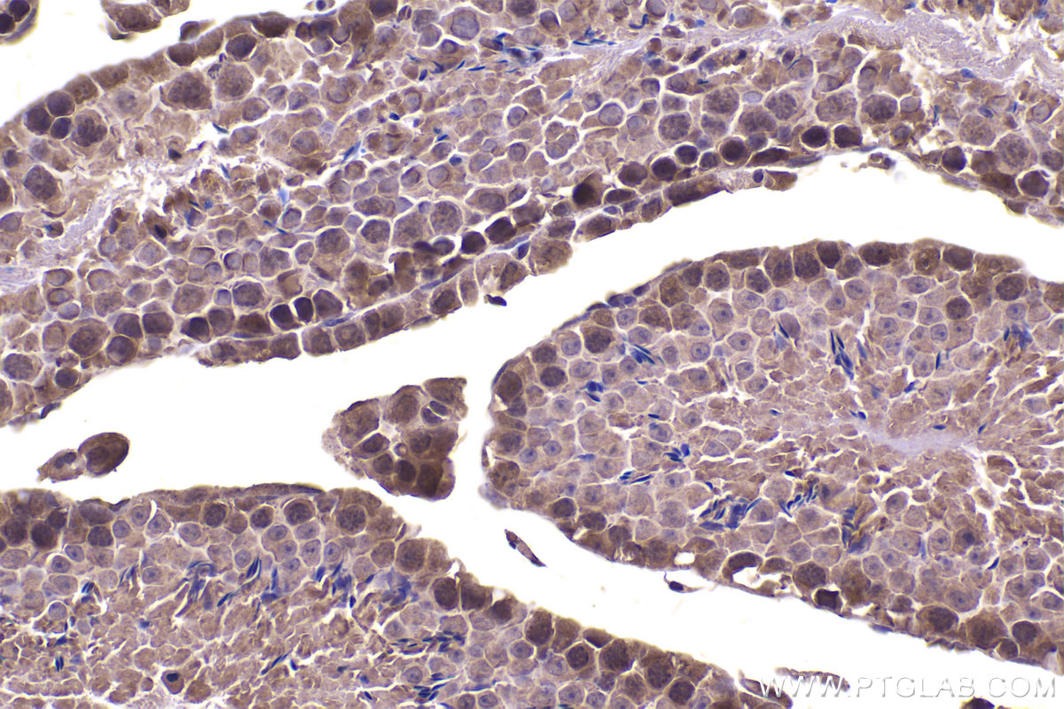 Immunohistochemical analysis of paraffin-embedded mouse testis tissue slide using KHC2346 (CSNK1A1 IHC Kit).