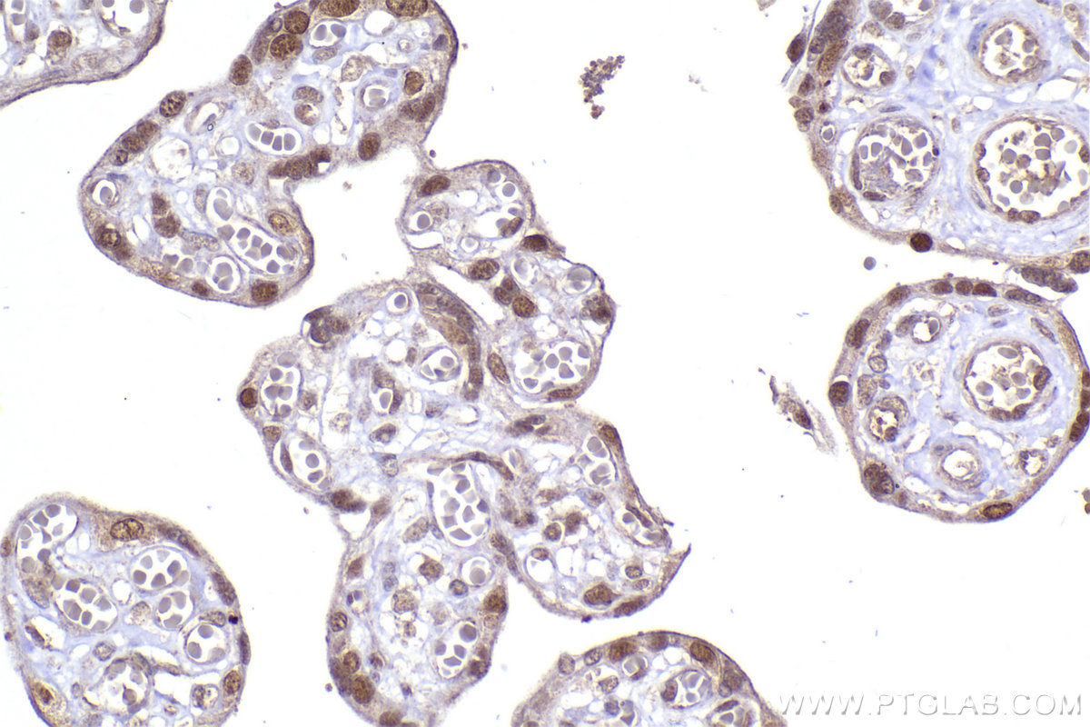 Immunohistochemical analysis of paraffin-embedded human placenta tissue slide using KHC2289 (CSNK1E IHC Kit).