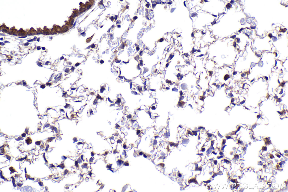 Immunohistochemical analysis of paraffin-embedded mouse lung tissue slide using KHC2289 (CSNK1E IHC Kit).