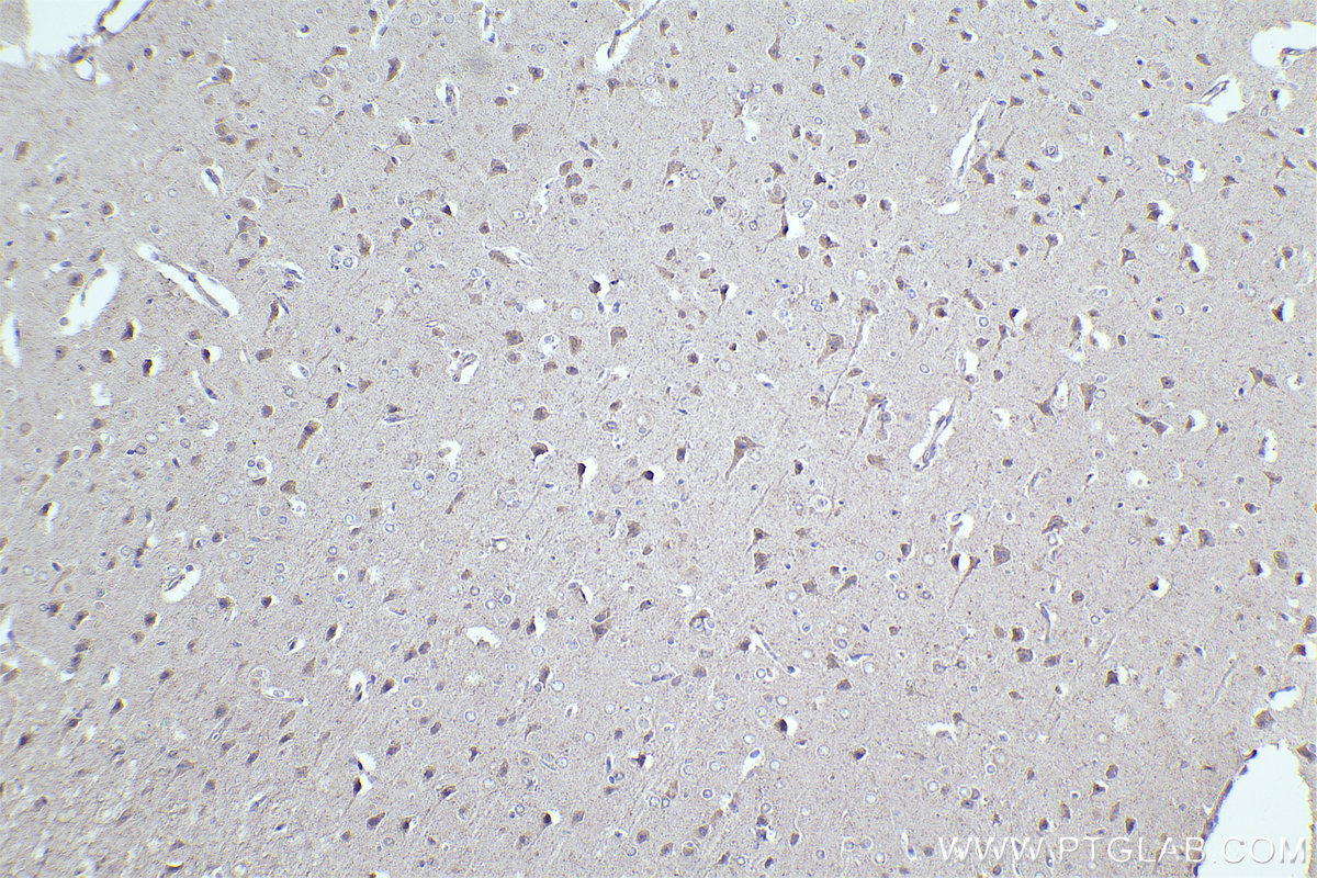 Immunohistochemical analysis of paraffin-embedded rat brain tissue slide using KHC2289 (CSNK1E IHC Kit).