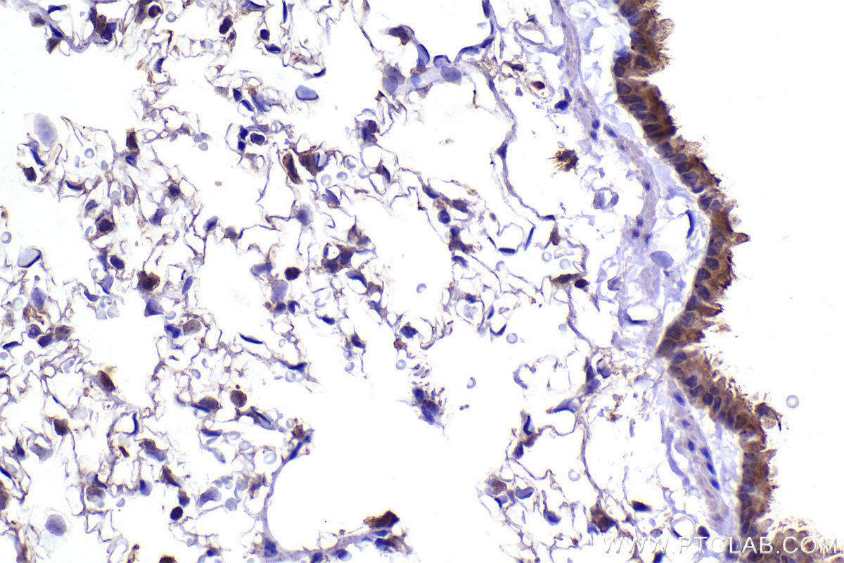 Immunohistochemical analysis of paraffin-embedded rat lung tissue slide using KHC2289 (CSNK1E IHC Kit).