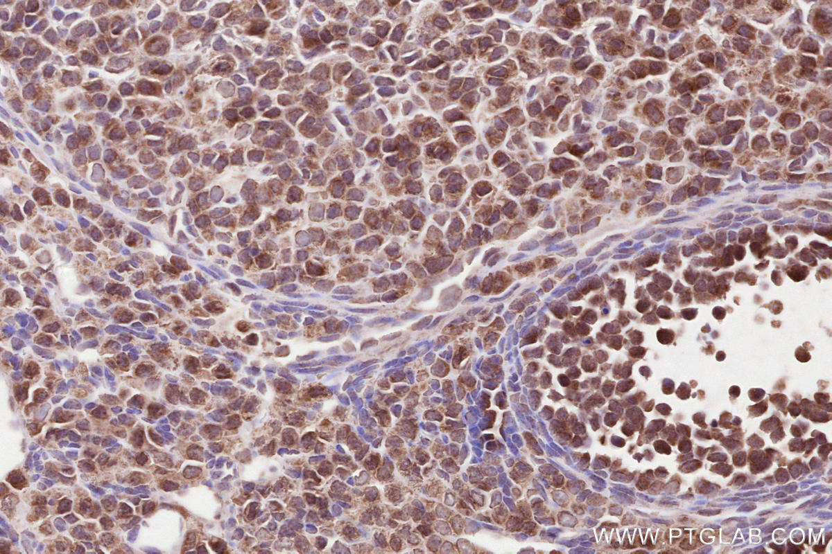 Immunohistochemical analysis of paraffin-embedded mouse ovary tissue slide using KHC2524 (CSPP1 IHC Kit).