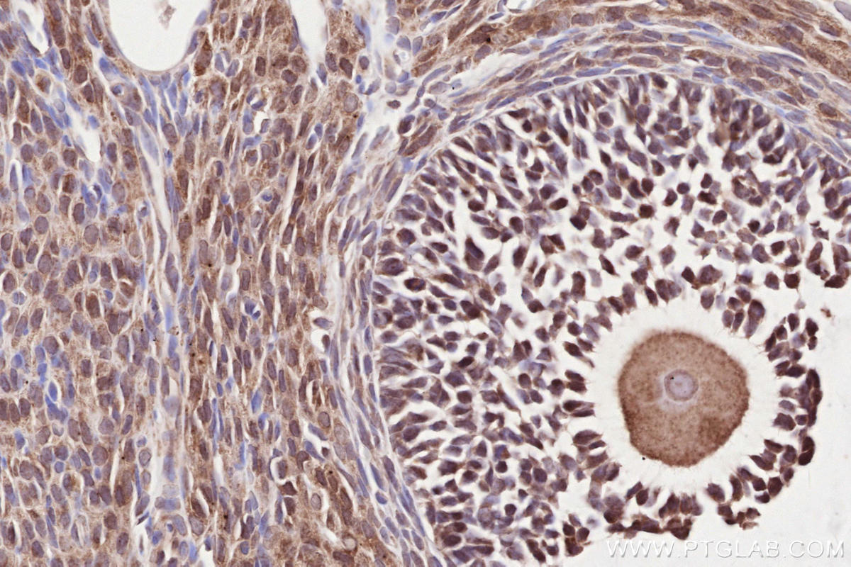 Immunohistochemical analysis of paraffin-embedded rat ovary tissue slide using KHC2524 (CSPP1 IHC Kit).