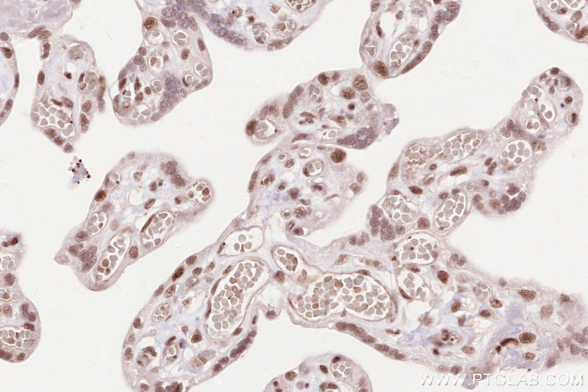 Immunohistochemical analysis of paraffin-embedded human placenta tissue slide using KHC2587 (CTR9 IHC Kit).