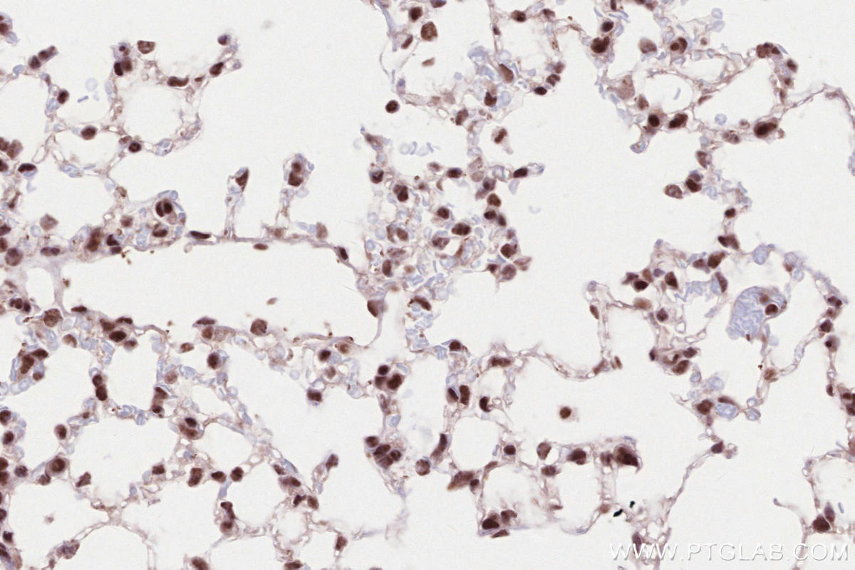 Immunohistochemical analysis of paraffin-embedded mouse lung tissue slide using KHC2587 (CTR9 IHC Kit).