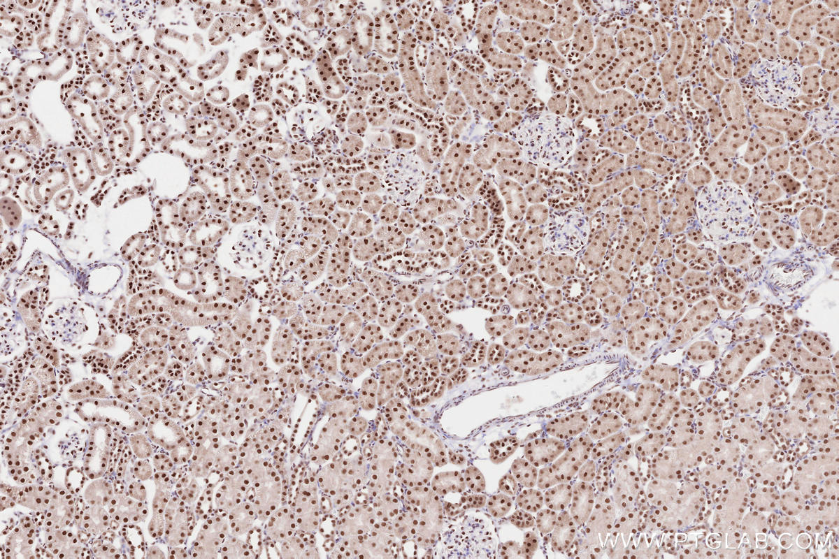 Immunohistochemical analysis of paraffin-embedded rat kidney tissue slide using KHC2587 (CTR9 IHC Kit).