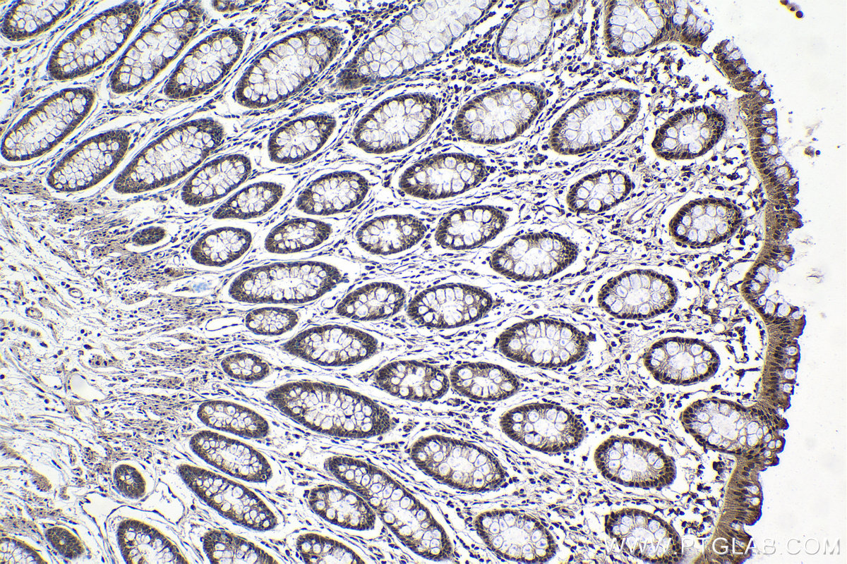 Immunohistochemical analysis of paraffin-embedded human colon tissue slide using KHC1035 (CUL1 IHC Kit).