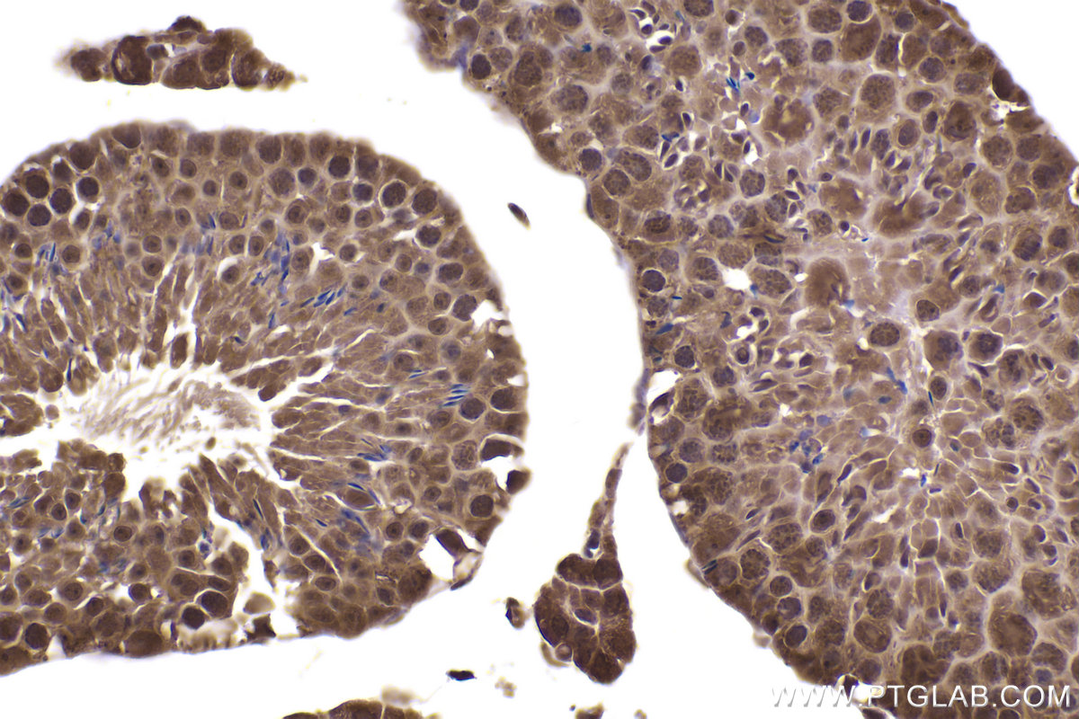 Immunohistochemical analysis of paraffin-embedded mouse testis tissue slide using KHC2437 (CUL2 IHC Kit).