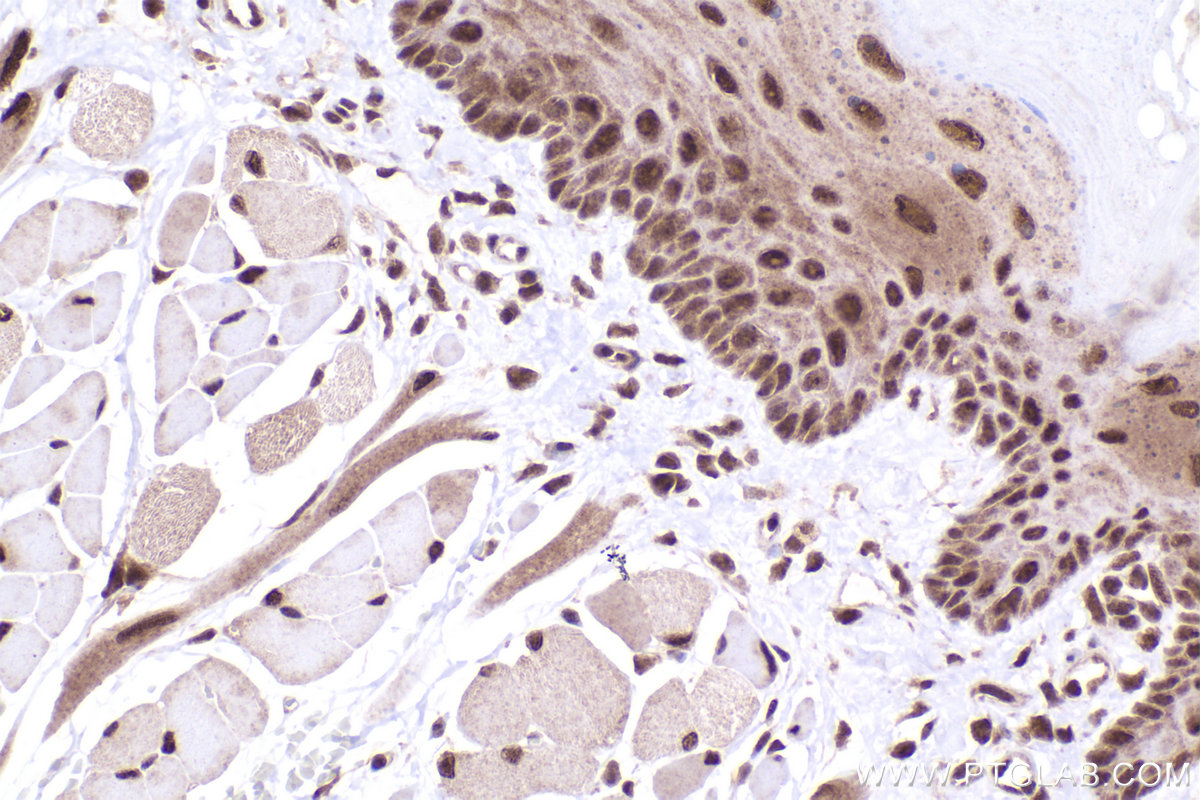 Immunohistochemical analysis of paraffin-embedded rat tongue tissue slide using KHC2438 (CUL4A IHC Kit).