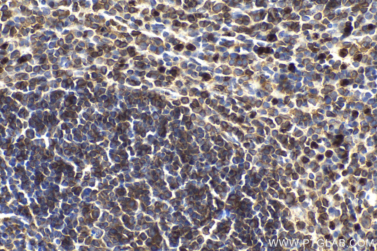 Immunohistochemical analysis of paraffin-embedded mouse spleen tissue slide using KHC2158 (CYBB/NOX2 IHC Kit).