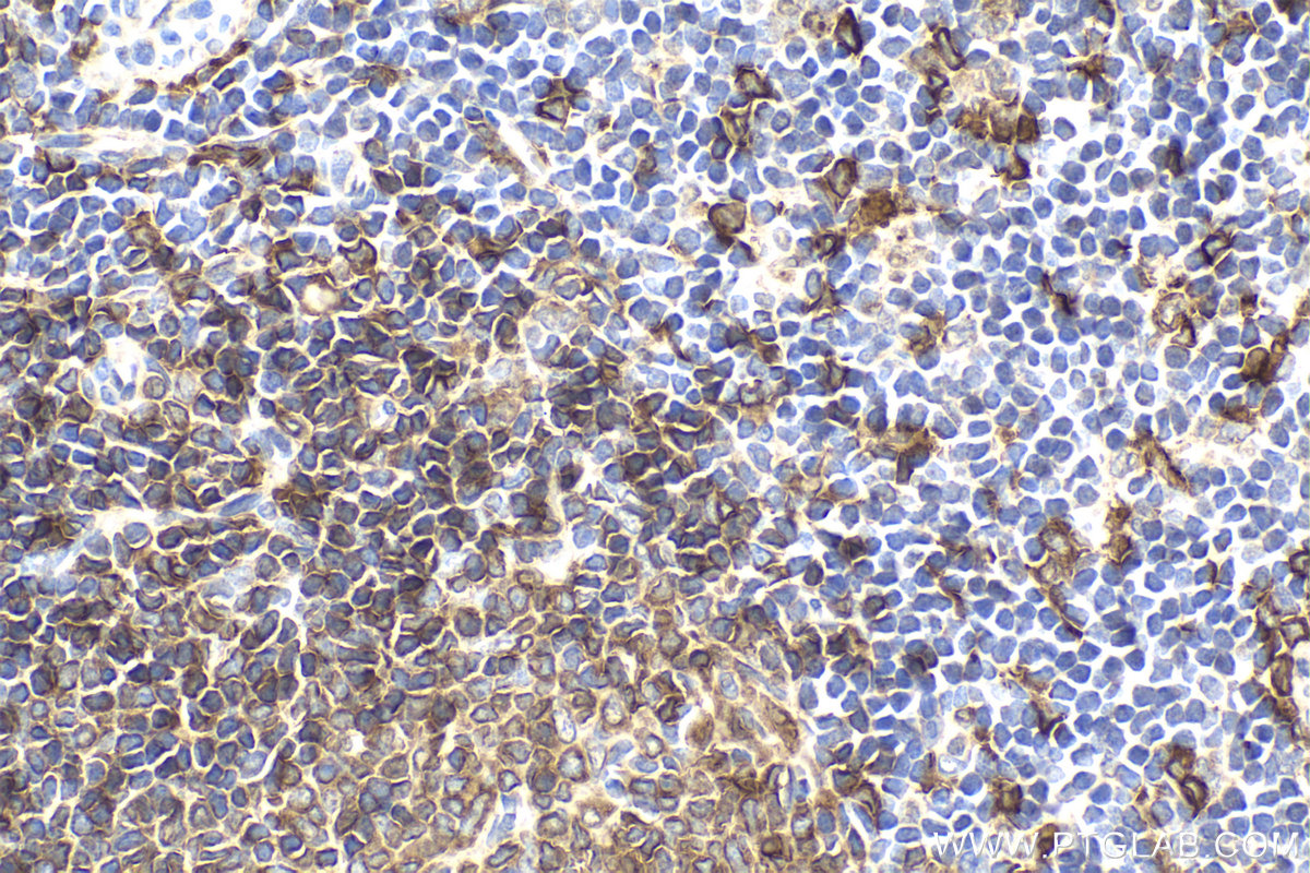 Immunohistochemical analysis of paraffin-embedded rat spleen tissue slide using KHC2158 (CYBB/NOX2 IHC Kit).