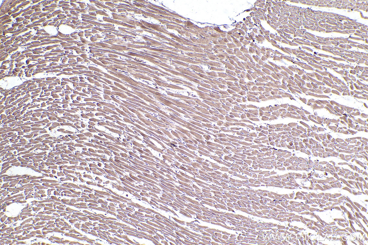 Immunohistochemical analysis of paraffin-embedded rat heart tissue slide using KHC2505 (CYP1B1 IHC Kit).