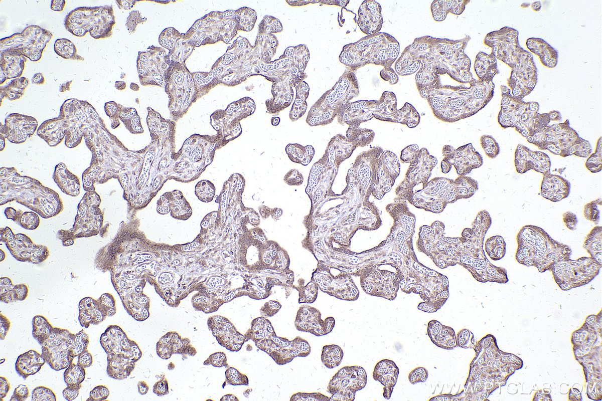 Immunohistochemical analysis of paraffin-embedded human placenta tissue slide using KHC2505 (CYP1B1 IHC Kit).