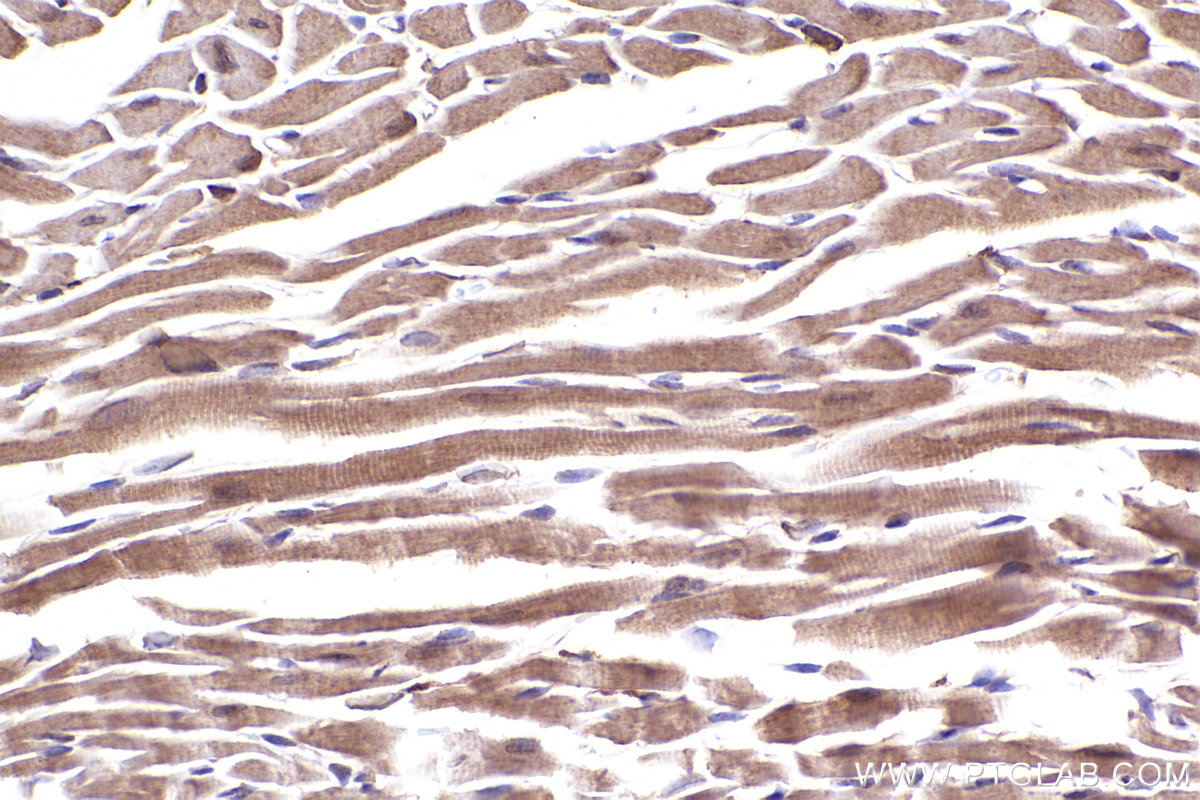 Immunohistochemical analysis of paraffin-embedded mouse heart tissue slide using KHC2505 (CYP1B1 IHC Kit).