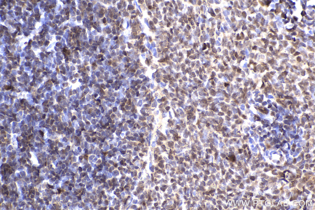 Immunohistochemical analysis of paraffin-embedded rat spleen tissue slide using KHC2214 (DCK IHC Kit).