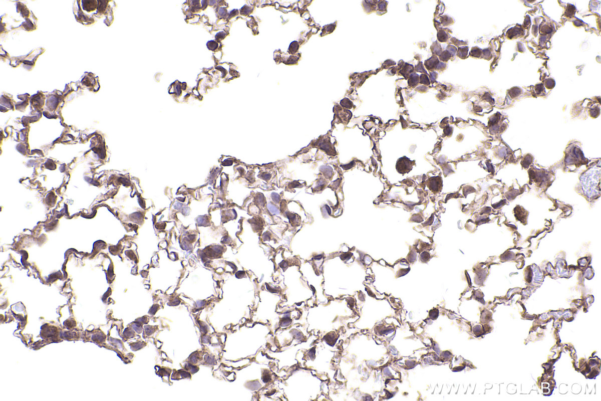 Immunohistochemical analysis of paraffin-embedded mouse lung tissue slide using KHC2523 (DDR2 IHC Kit).