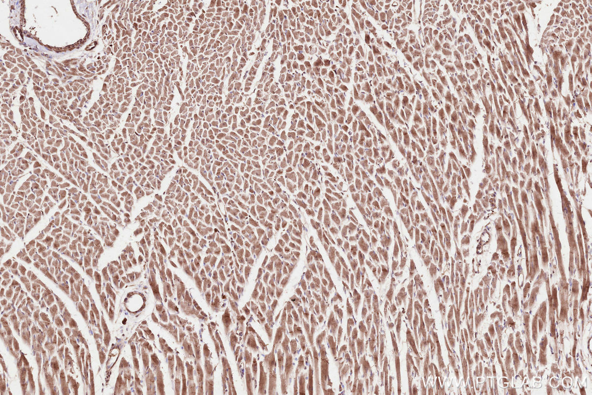 Immunohistochemical analysis of paraffin-embedded rat heart tissue slide using KHC2523 (DDR2 IHC Kit).