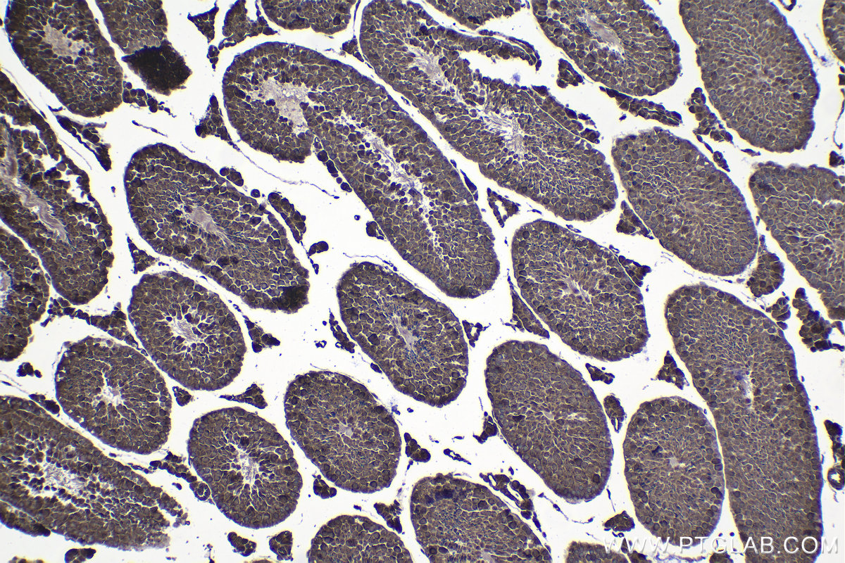 Immunohistochemical analysis of paraffin-embedded mouse testis tissue slide using KHC1424 (DDX3 IHC Kit).