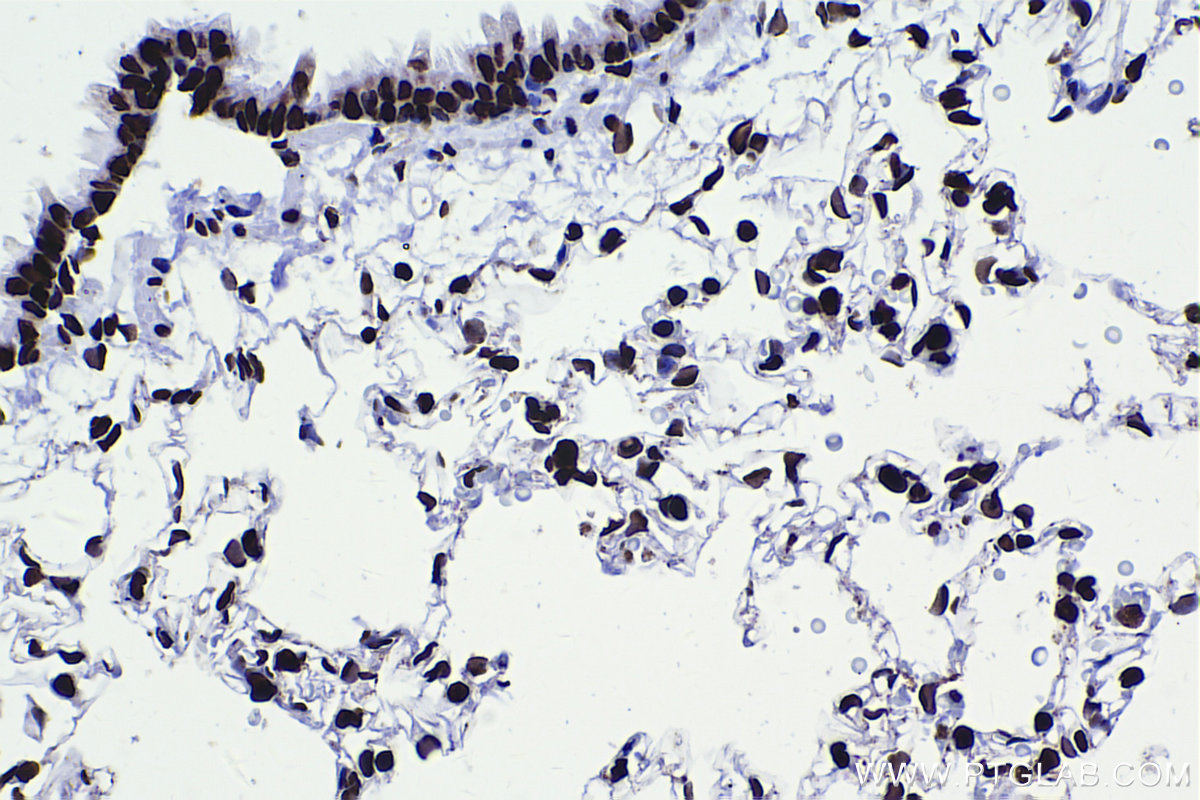 Immunohistochemical analysis of paraffin-embedded rat lung tissue slide using KHC2248 (DEK IHC Kit).