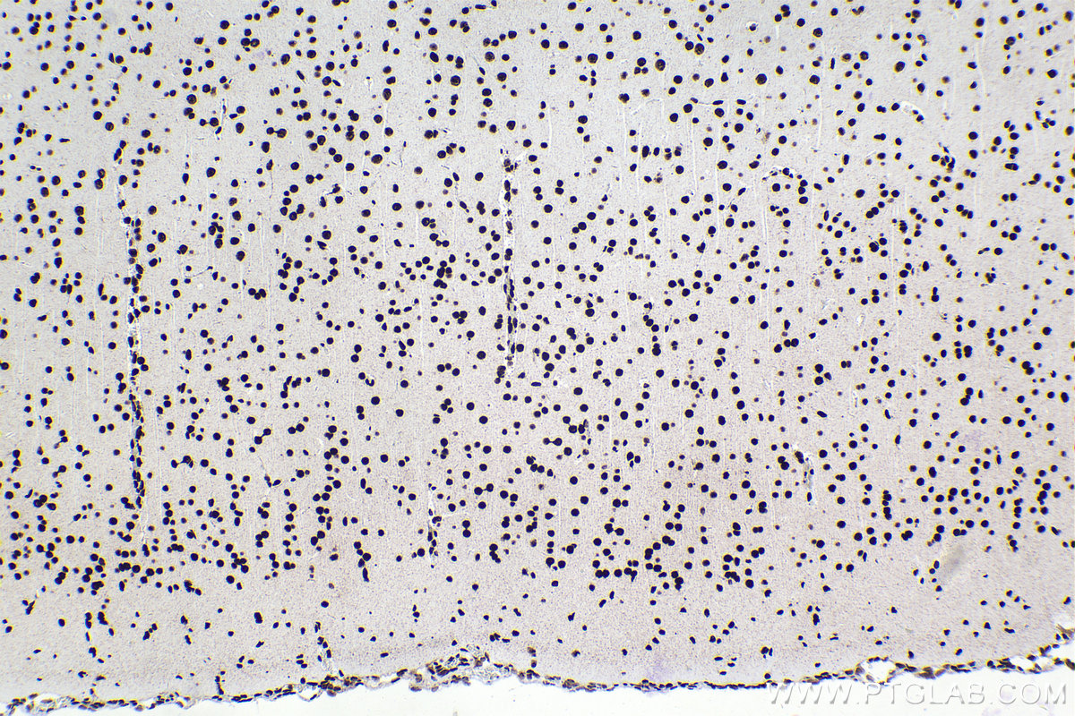 Immunohistochemical analysis of paraffin-embedded rat brain tissue slide using KHC2248 (DEK IHC Kit).