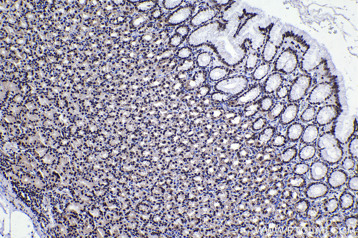 Immunohistochemical analysis of paraffin-embedded human stomach tissue slide using KHC2248 (DEK IHC Kit).