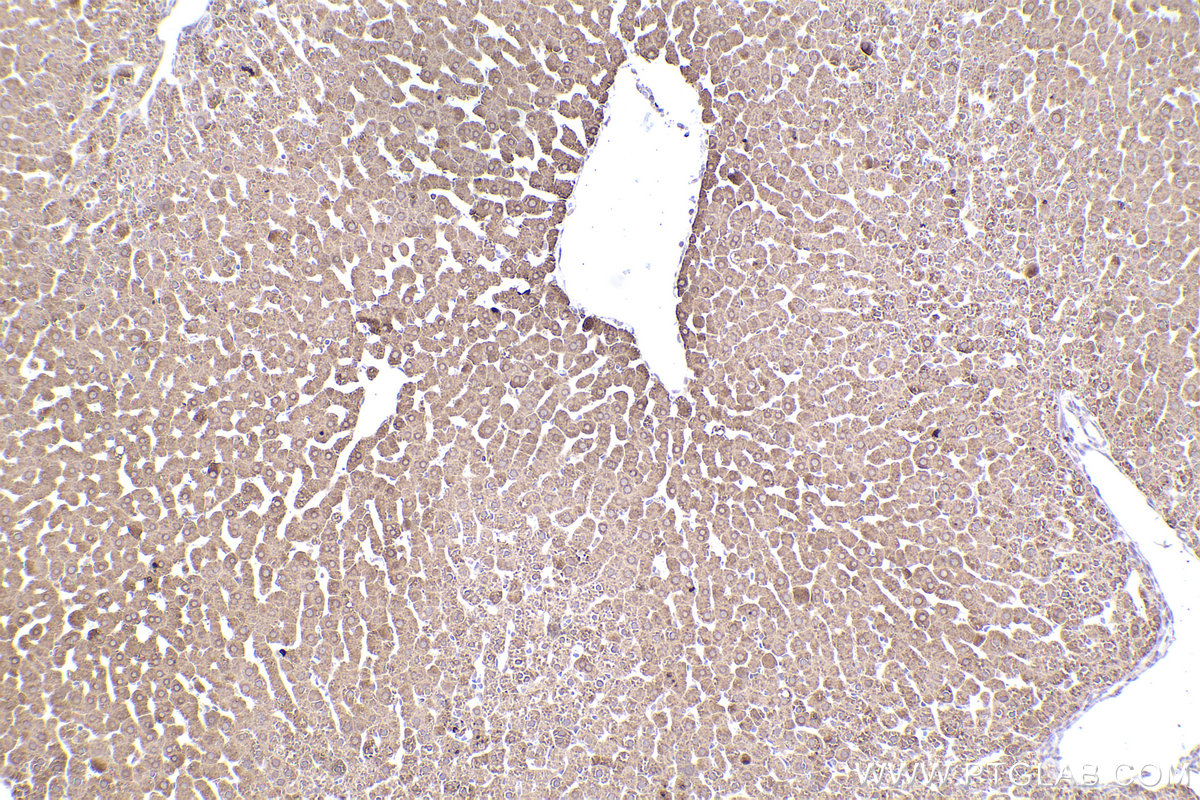 Immunohistochemical analysis of paraffin-embedded rat liver tissue slide using KHC2488 (DHCR24 IHC Kit).