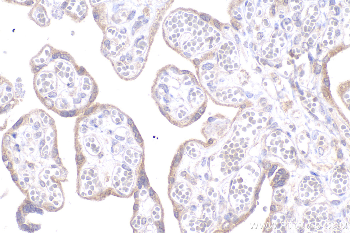 Immunohistochemical analysis of paraffin-embedded human placenta tissue slide using KHC2140 (DHRS3 IHC Kit).